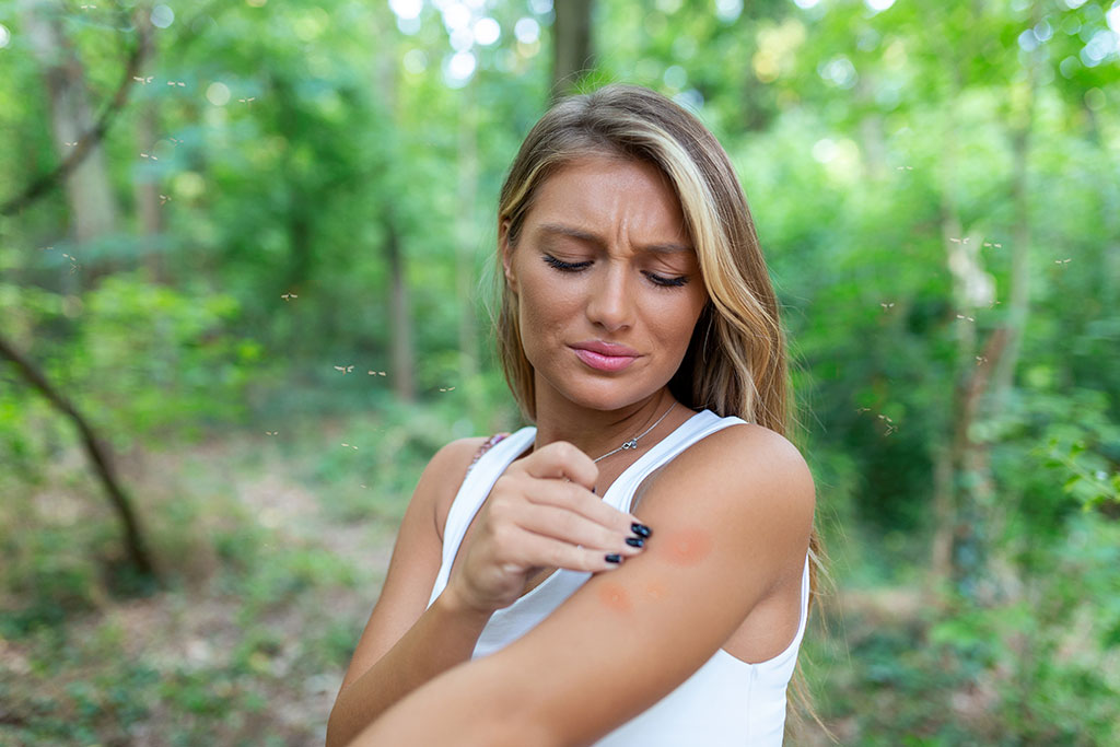 Woman outside scratching bug bite